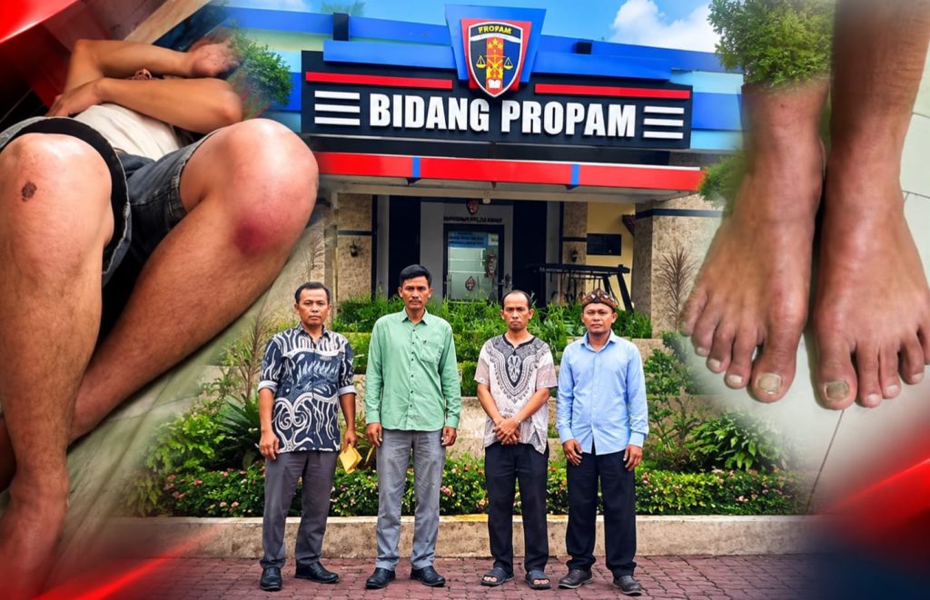 Seorang Pria Warga Kabupaten Dairi Mengaku Disiksa Oleh 7 Personil Polres Samosir ,Kini Melapor Ke Propam Polda Sumut